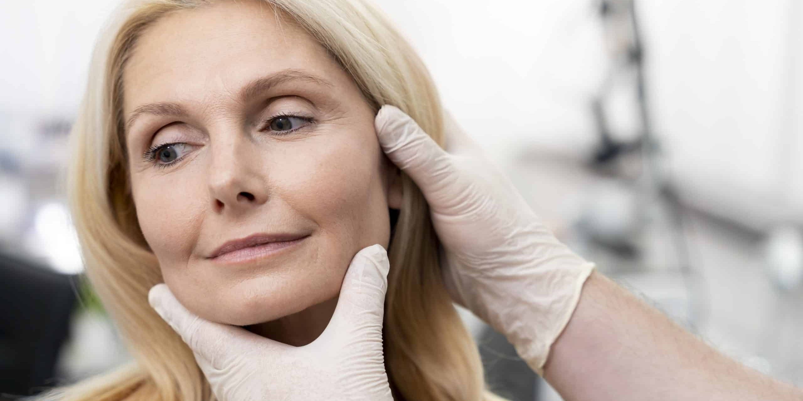Recovery After a Deep Plane Facelift